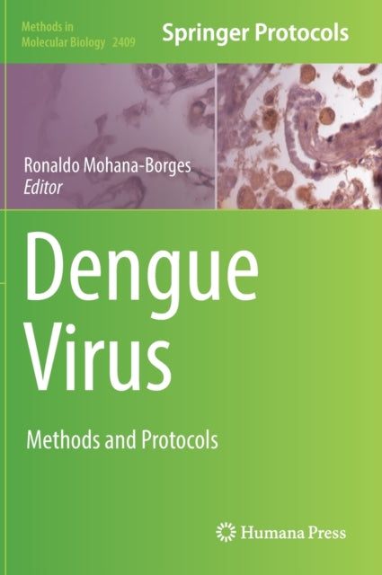 Book cover of: Dengue Virus. By: Ronaldo Mohana-Borges