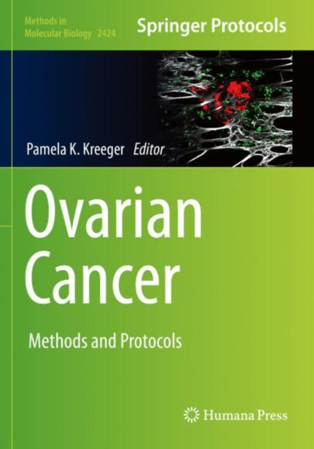 Book cover of: Ovarian Cancer. By: Pamela K. Kreeger