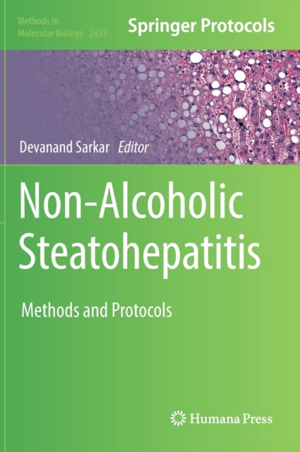 Book cover of: Non-Alcoholic Steatohepatitis. By: Devanand Sarkar