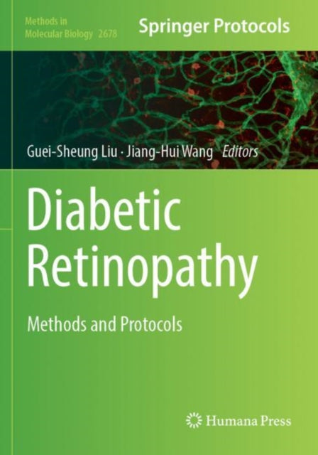 Book cover of: Diabetic Retinopathy. By: Guei-Sheung Liu