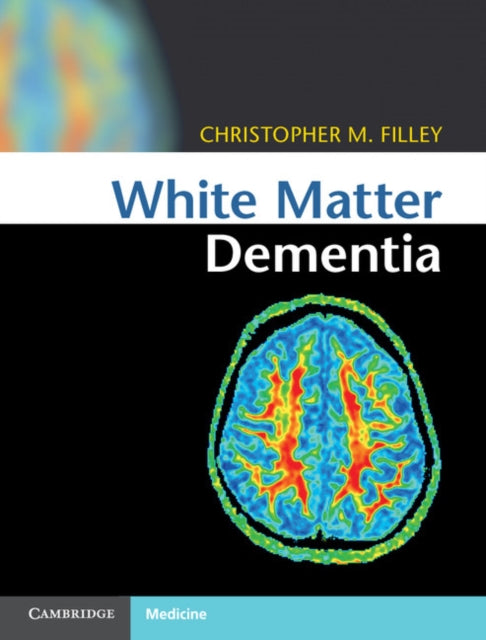 Book cover of: White Matter Dementia. By: Christopher M. Filley