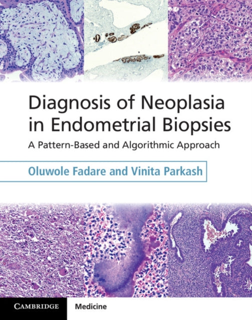 Book cover of: Diagnosis of Neoplasia in Endometrial Biopsies Book and Online Bundle. By: Oluwole Fadare