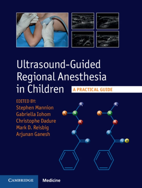 Book cover of: Ultrasound-Guided Regional Anesthesia in Children. By: Stephen Mannion