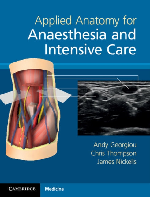 Book cover of: Applied Anatomy for Anaesthesia and Intensive Care