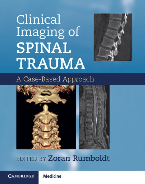 Book cover of: Clinical Imaging of Spinal Trauma. By: Zoran Rumboldt