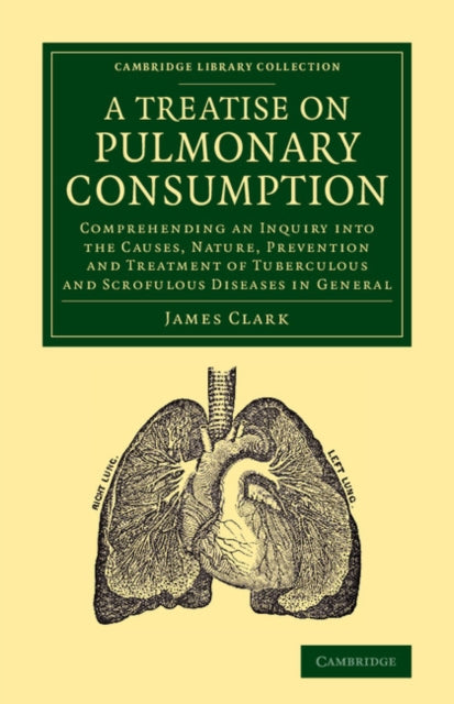 Book cover of: Treatise on Pulmonary Consumption