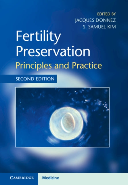 Book cover of: Fertility Preservation. By: Jacques Donnez