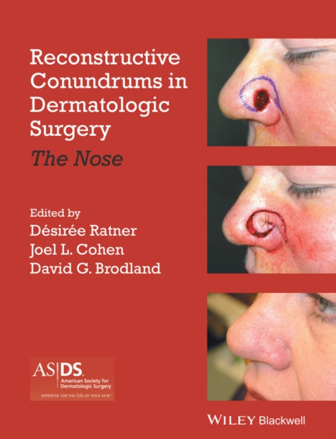 Book cover of: Reconstructive Conundrums in Dermatologic Surgery