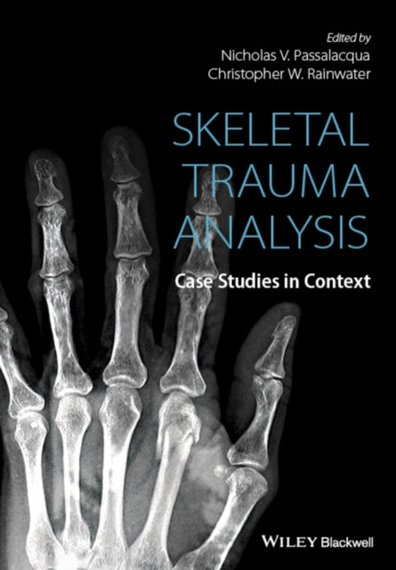 Book cover of: Skeletal Trauma Analysis