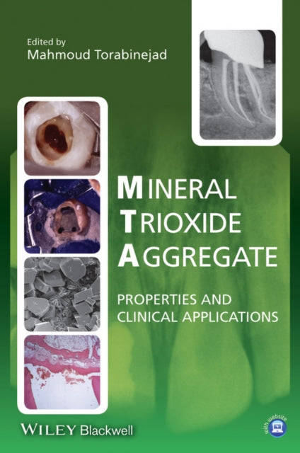 Book cover of: Mineral Trioxide Aggregate
