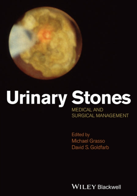 Book cover of: Urinary Stones
