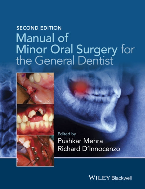 Book cover of: Manual of Minor Oral Surgery for the General Dentist. By: Pushkar Mehra