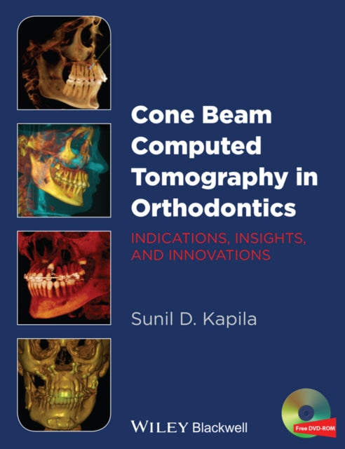 Book cover of: Cone Beam Computed Tomography in Orthodontics