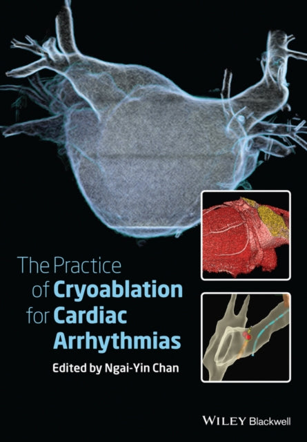 Book cover of: Practice of Catheter Cryoablation for Cardiac Arrhythmias