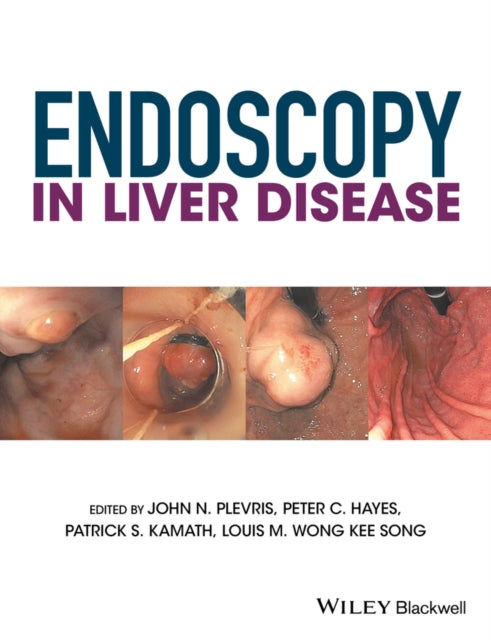 Book cover of: Endoscopy in Liver Disease. By: John N. Plevris