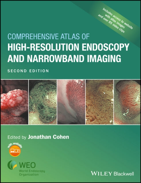 Book cover of: Comprehensive Atlas of High-Resolution Endoscopy and Narrowband Imaging