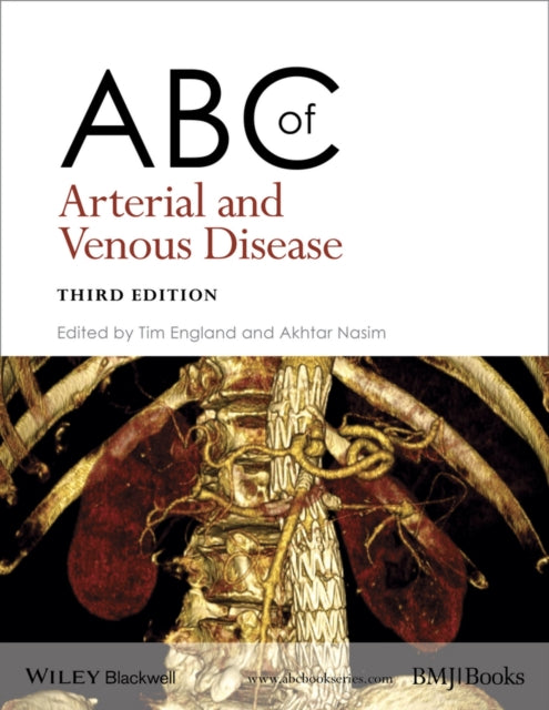 Book cover of: ABC of Arterial and Venous Disease