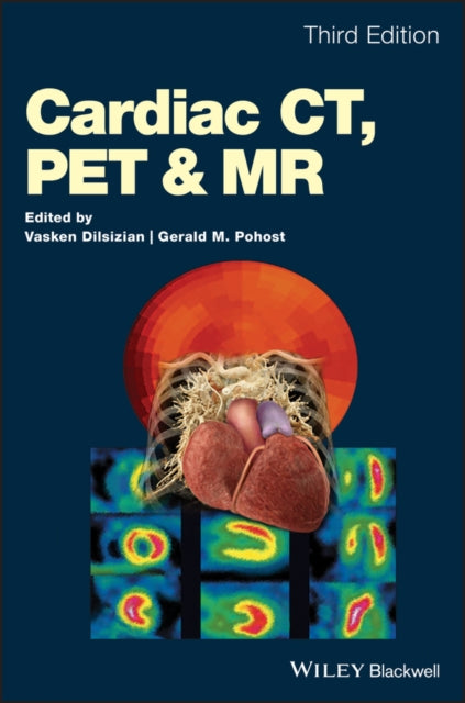 Book cover of: Cardiac CT, PET and MR. By: Vasken Dilsizian