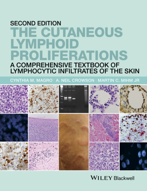 Book cover of: Cutaneous Lymphoid Proliferations. By: Cynthia M. Magro