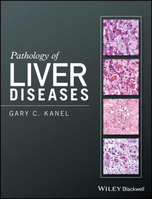 Book cover of: Pathology of Liver Diseases. By: Gary C. Kanel