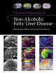 Book cover of: Clinical Dilemmas in Non-Alcoholic Fatty Liver Disease. By: Roger Williams
