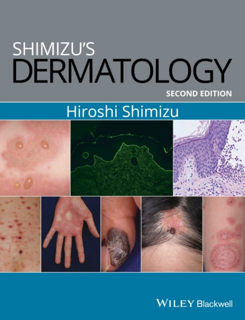 Book cover of: Shimizu's Dermatology. By: Hiroshi Shimizu