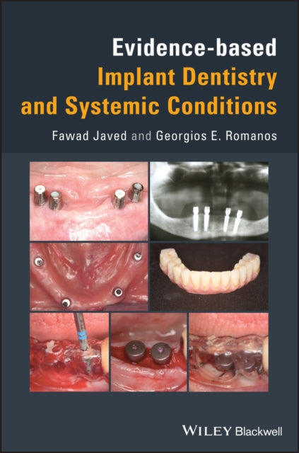 Book cover of: Evidence-based Implant Dentistry and Systemic Conditions. By: Fawad Javed
