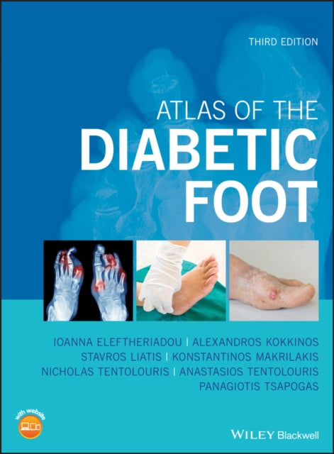 Book cover of: Atlas of the Diabetic Foot. By: Ioanna Eleftheriadou