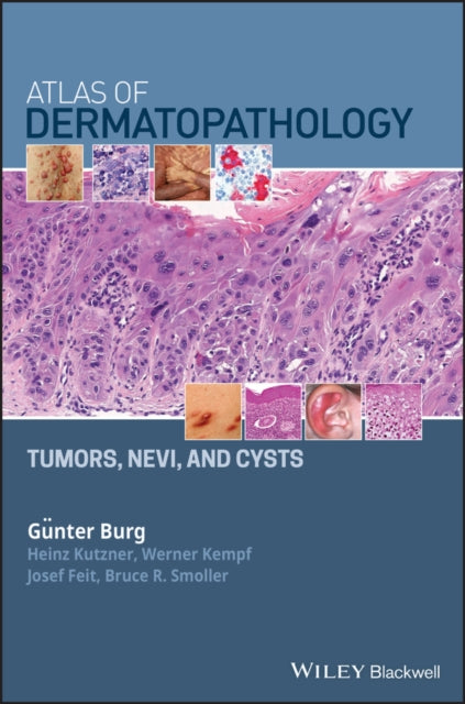 Book cover of: Atlas of Dermatopathology. By: Günter Burg