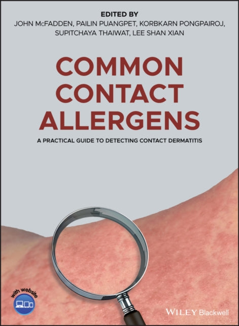 Book cover of: Common Contact Allergens. By: John McFadden