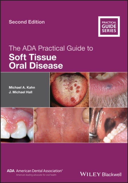 Book cover of: ADA Practical Guide to Soft Tissue Oral Disease. By: Michael A. Kahn