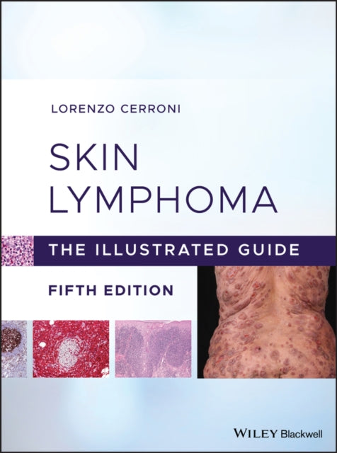 Book cover of: Skin Lymphoma. By: Lorenzo Cerroni