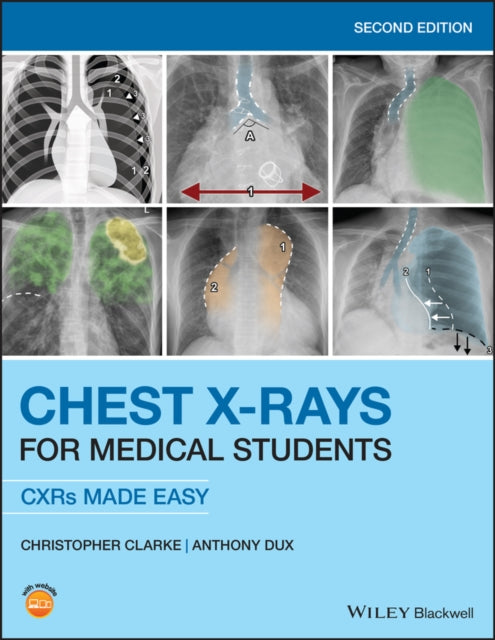 Book cover of: Chest X-Rays for Medical Students. By: Christopher Clarke