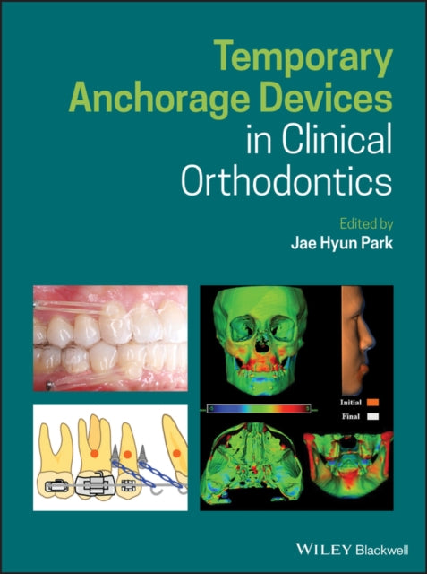 Book cover of: Temporary Anchorage Devices in Clinical Orthodontics. By: Jae Hyun Park