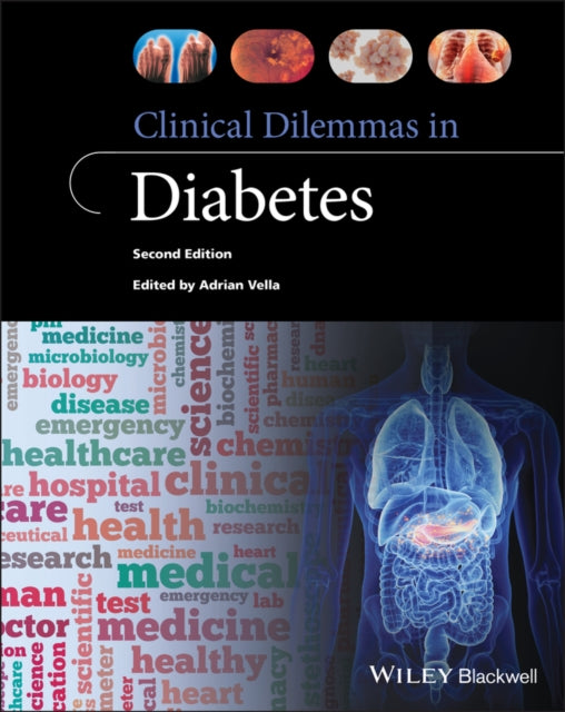 Book cover of: Clinical Dilemmas in Diabetes. By: Adrian Vella
