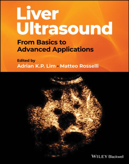 Book cover of: Liver Ultrasound. By: A. Lim