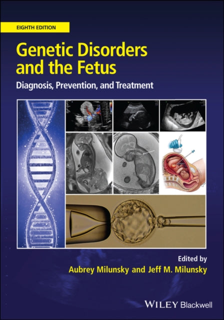 Book cover of: Genetic Disorders and the Fetus. By: Aubrey Milunsky