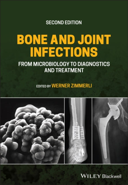 Book cover of: Bone and Joint Infections. By: Werner Zimmerli