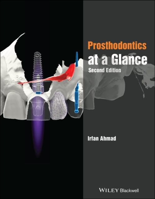 Book cover of: Prosthodontics at a Glance. By: Irfan Ahmad
