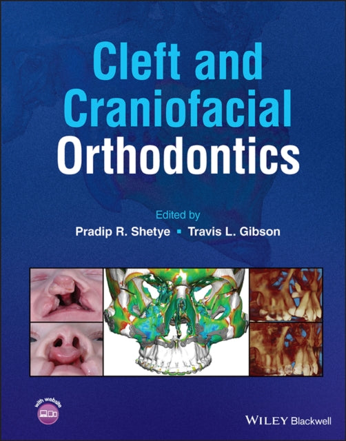 Book cover of: Cleft and Craniofacial Orthodontics. By: Pradip R. Shetye