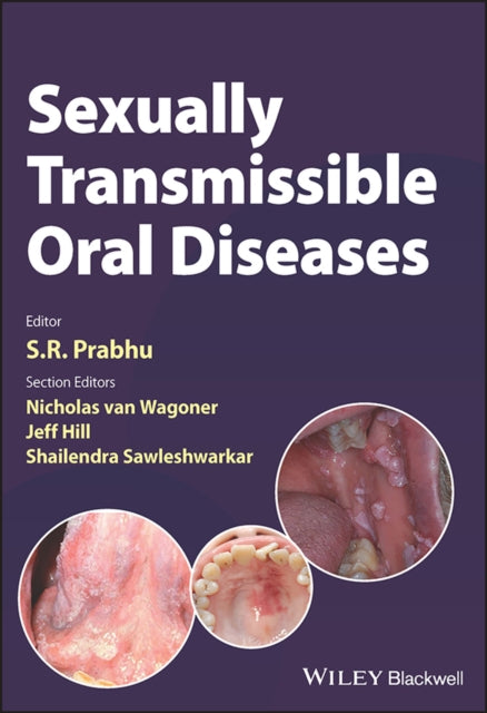 Book cover of: Sexually Transmissible Oral Diseases. By: S. R. Prabhu