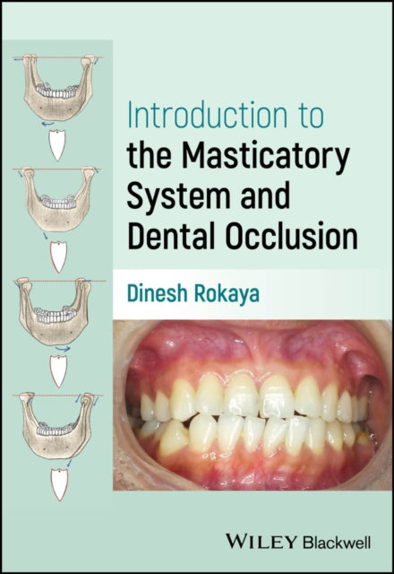 Book cover of: Introduction to the Masticatory System and Dental Occlusion. By: Dinesh Rokaya