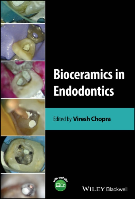 Book cover of: Bioceramics in Endodontics. By: Viresh Chopra