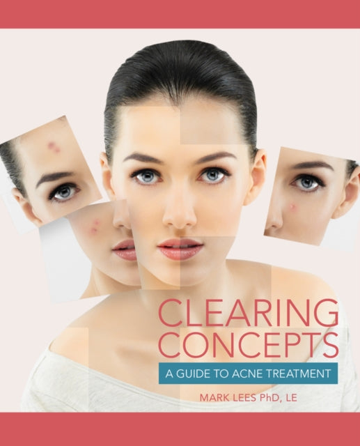 Book cover of: Clearing Concepts. By: Mark Lees