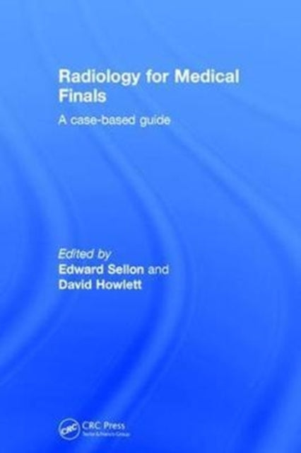 Book cover of: Radiology for Medical Finals. By: Edward Sellon