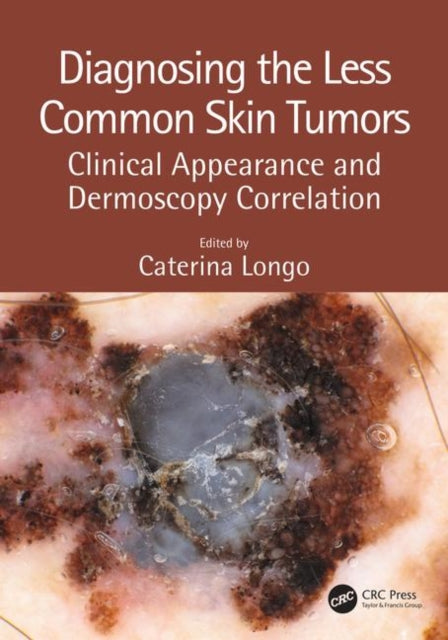 Book cover of: Diagnosing the Less Common Skin Tumors. By: Caterina Longo