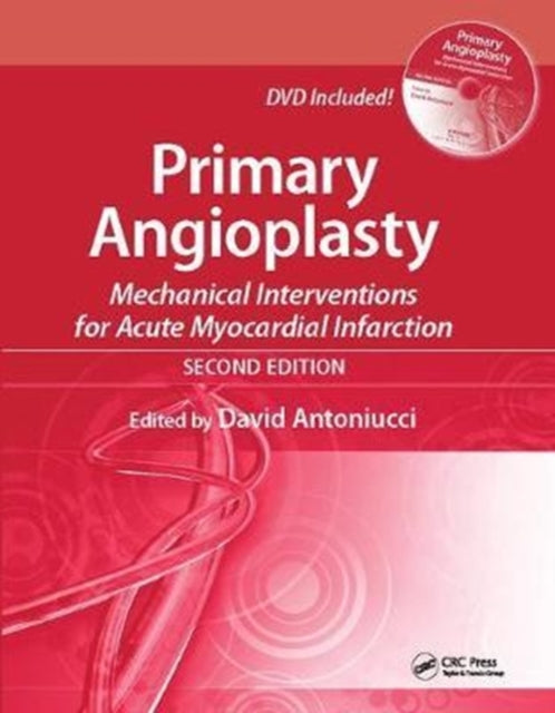 Book cover of: Primary Angioplasty. By: David Antoniucci