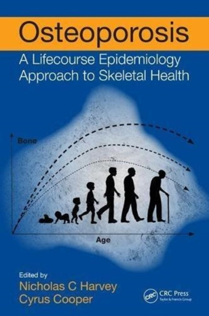 Book cover of: Osteoporosis. By: Nicholas Harvey