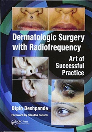 Dermatologic Surgery with Radiofrequency
