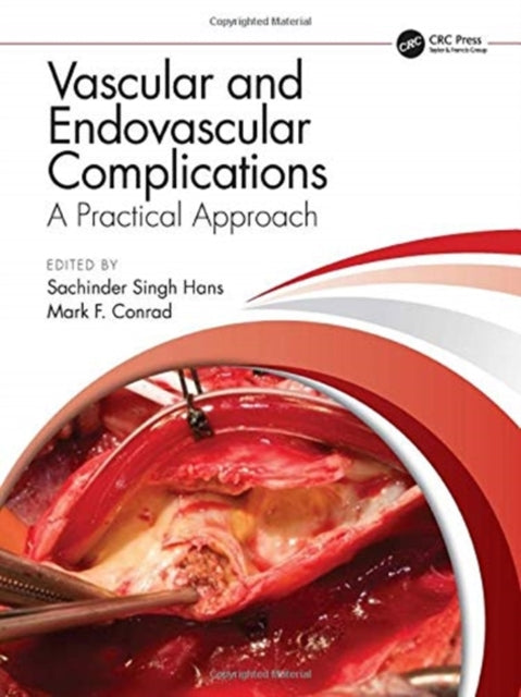Book cover of: Vascular and Endovascular Complications: A Practical Approach. By: S. S. Hans